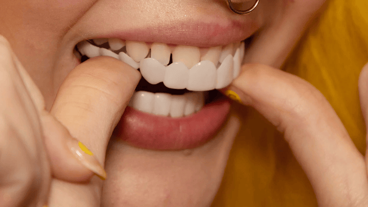 Sandsberg | Snap-On Smile Veneers | Natychmiastowe wybielanie zębów | Rozmiar uniwersalny