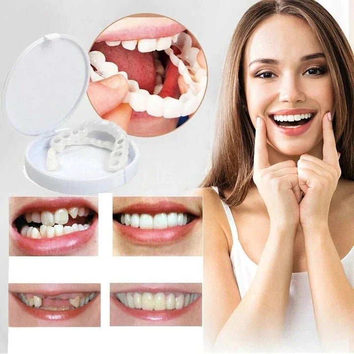 Sandsberg | Snap-On Smile Veneers | Natychmiastowe wybielanie zębów | Rozmiar uniwersalny