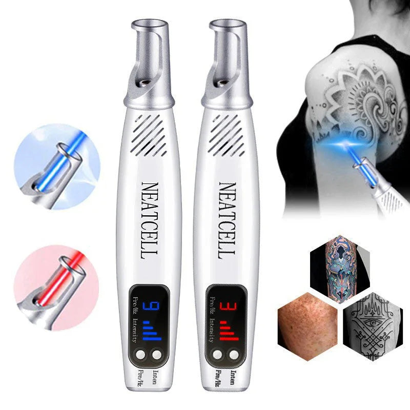 Karnz | Laserowy Stift do Usuwania Tatuaży | Usuwanie Tatuaży Laserem Czerwonym i Niebieskim