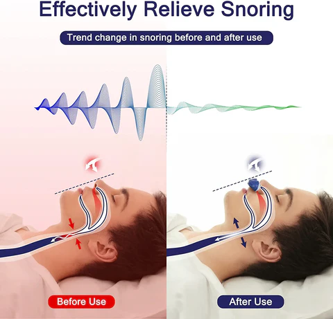 Mikro-CPAP urządzenie do leczenia bezdechu sennego na podróże i przeciw chrapaniu