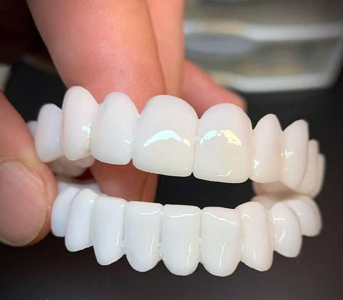 Kosmetyczne nakładki na zęby SmileVorm – Wielokrotnego użytku, elastyczne i naturalnie białe | Karnz