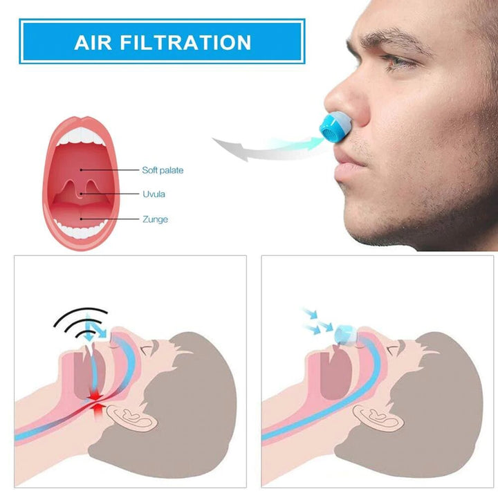 Urządzenie przeciw chrapaniu | Mikro-CPAP bez rurki i maski