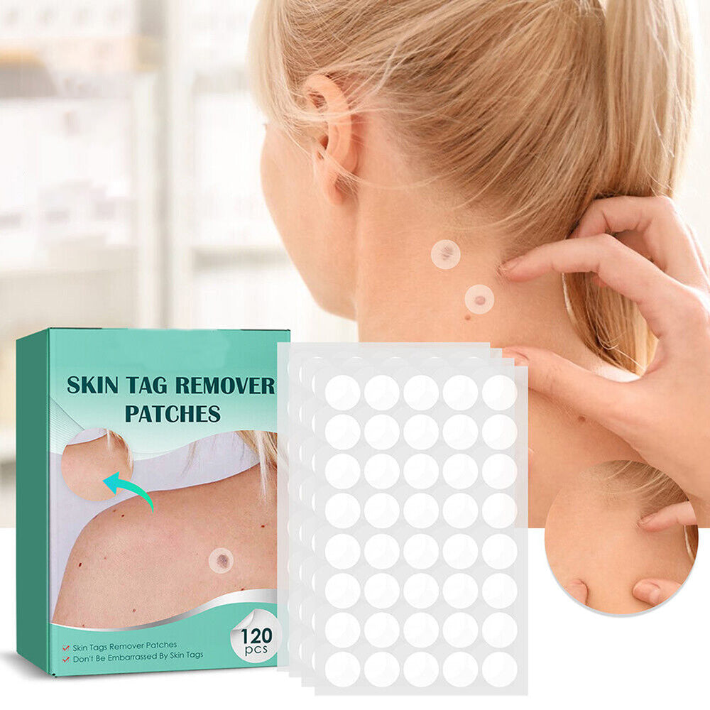 SkinClear - Plastry do usuwania plam i brodawek Karnz