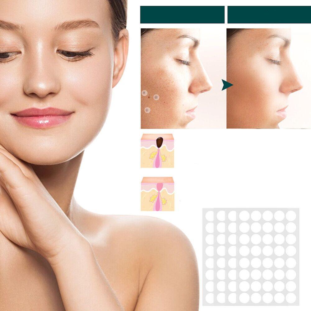 SkinClear - Plastry do usuwania plam i brodawek Karnz