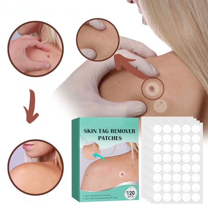 SkinClear - Plastry do usuwania plam i brodawek Karnz