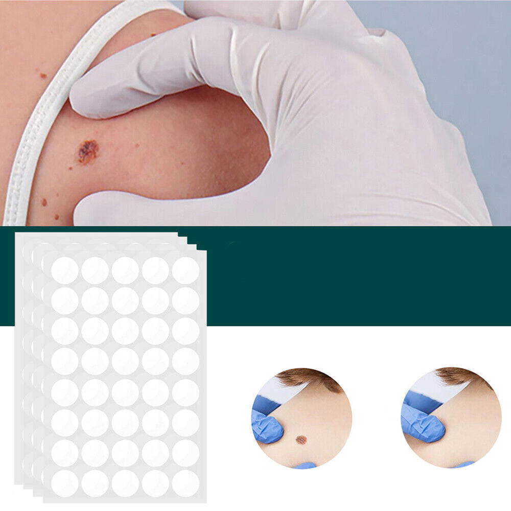 SkinClear - Plastry do usuwania plam i brodawek Karnz