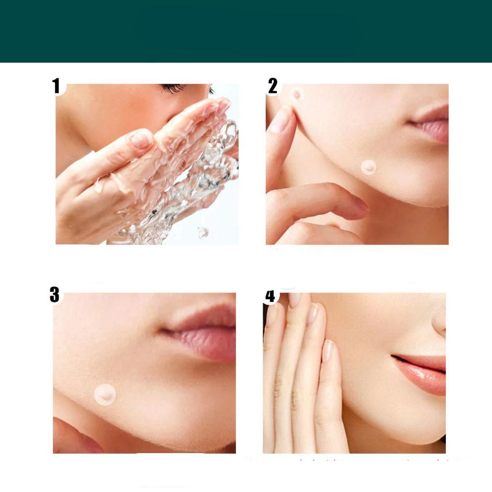SkinClear - Plastry do usuwania plam i brodawek Karnz