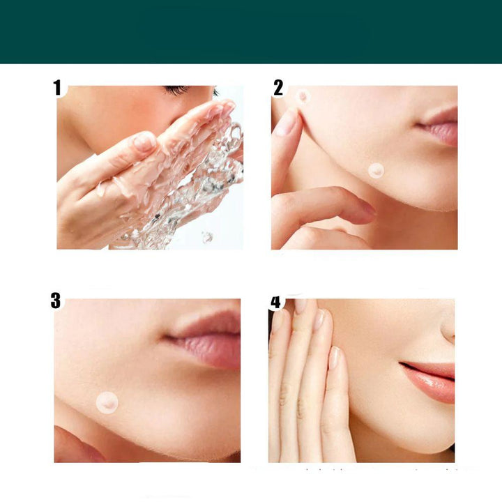 SkinClear - Plastry do usuwania plam i brodawek Karnz
