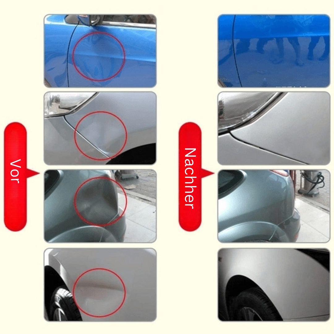 DeukFix Zestaw Naprawczy – Usuwanie Wgnieceń bez Uszkodzenia Lakieru | Karnz