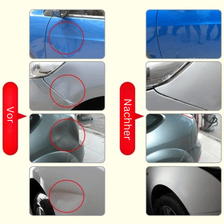 DeukFix Zestaw Naprawczy – Usuwanie Wgnieceń bez Uszkodzenia Lakieru | Karnz