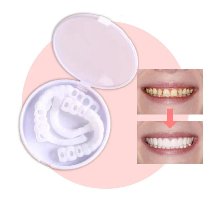 Snap-on Teeth™ – Z tymi licówkami zawsze będziesz mieć idealny uśmiech.
