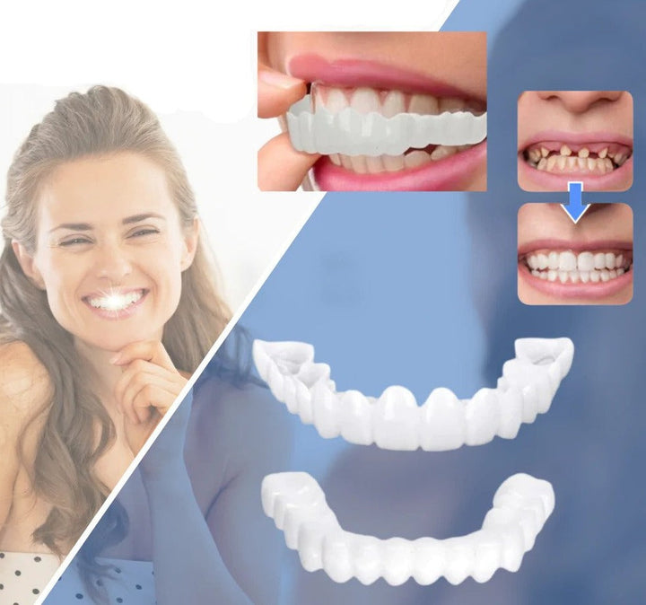 Snap-on Teeth™ – Z tymi licówkami zawsze będziesz mieć idealny uśmiech.