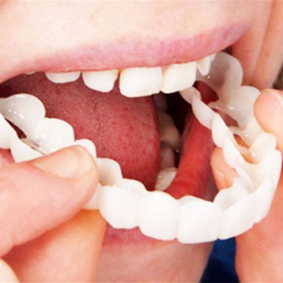 Snap-on Teeth™ – Z tymi licówkami zawsze będziesz mieć idealny uśmiech.